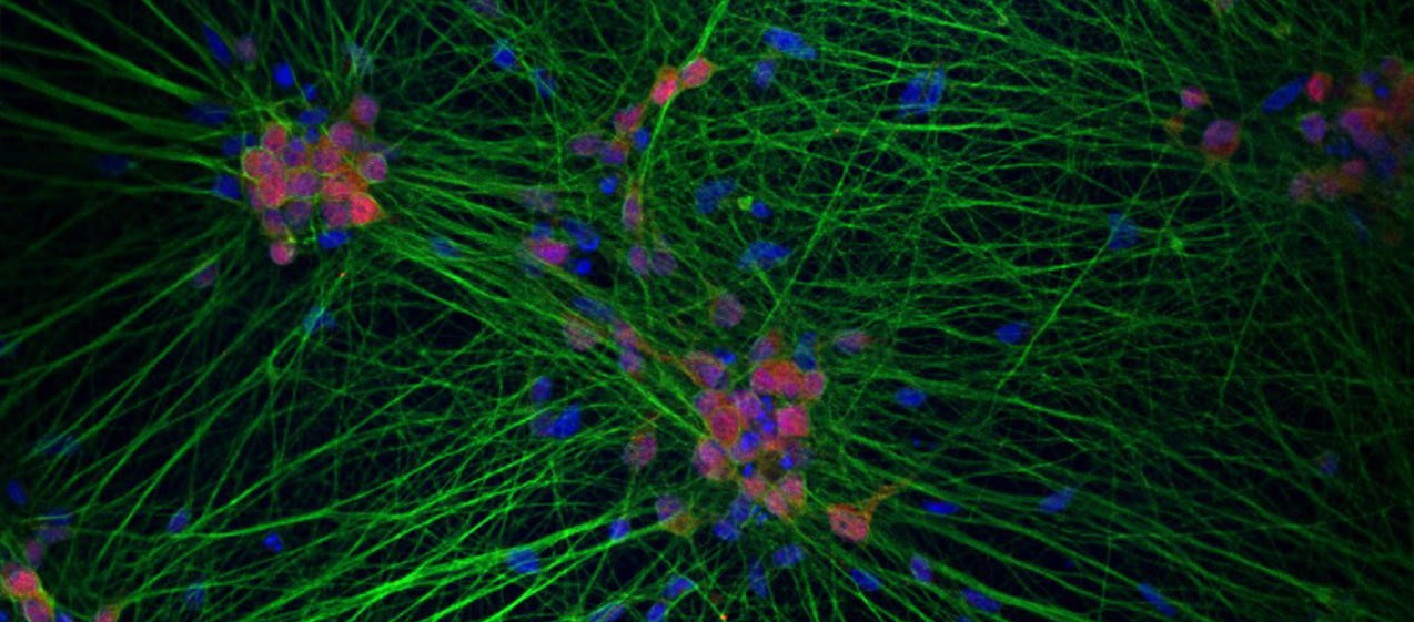 Human neurons derived from iPSCs, visualized with blue nuclei (DAPI) and pink processes (MAP2), showcasing cellular complexity relevant to nervous system disease research and public health care programs.